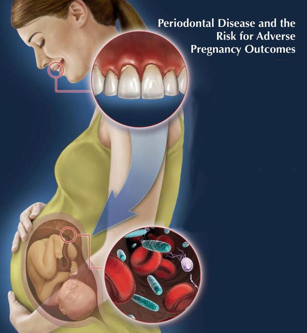 Pregnancy and Oral Health: Understanding the Research and the Importance of Dental Care